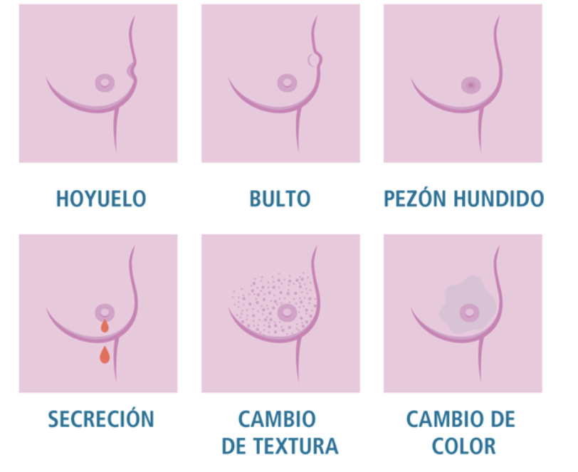Imagen1